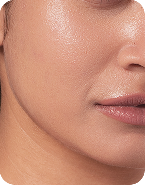 After skin comparison